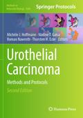 Urothelial Carcinoma