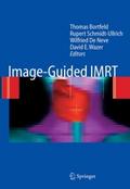 Image-Guided IMRT