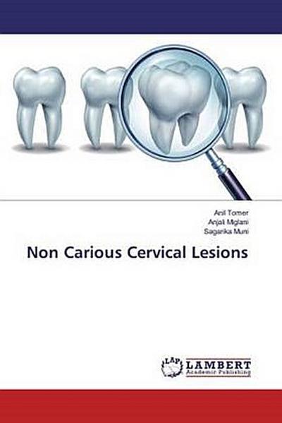 Non Carious Cervical Lesions