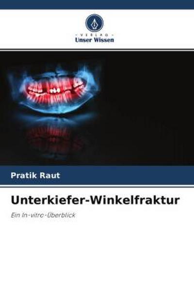 Unterkiefer-Winkelfraktur
