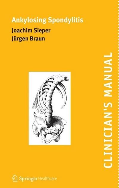Clinician’s Manual on Ankylosing Spondylitis