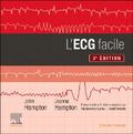 L’ECG facile