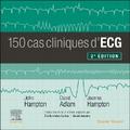 150 cas cliniques d’ECG
