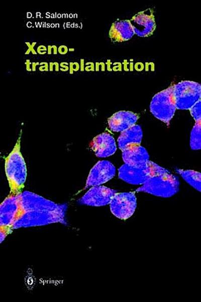 Xenotransplantation