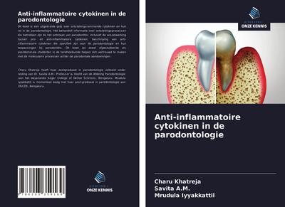 Anti-inflammatoire cytokinen in de parodontologie