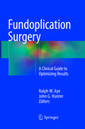Fundoplication Surgery