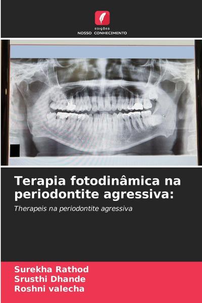 Terapia fotodinâmica na periodontite agressiva: