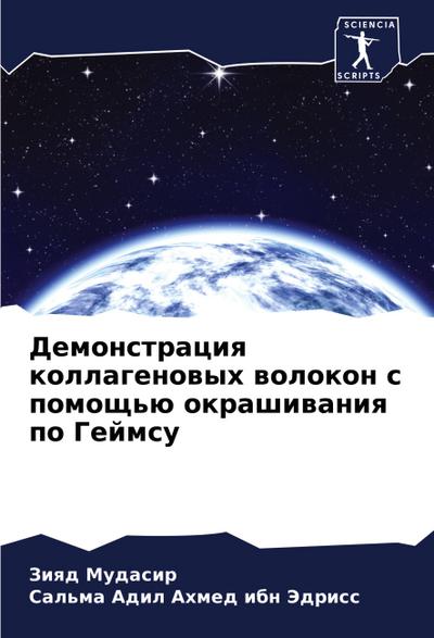 Demonstraciq kollagenowyh wolokon s pomosch’ü okrashiwaniq po Gejmsu