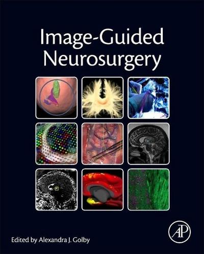 Image-Guided Neurosurgery