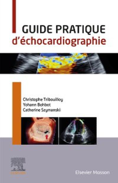 Guide pratique d’’échocardiographie