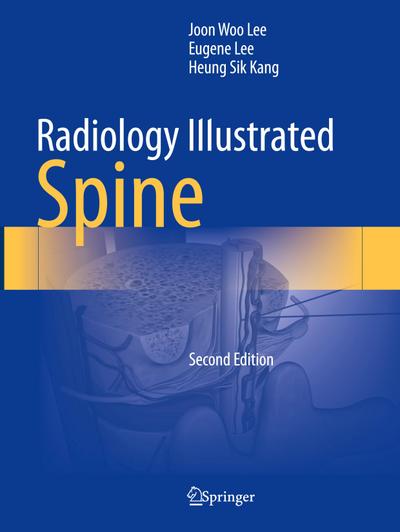 Radiology Illustrated: Spine