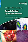 Das große Spektrum thyreoidaler Erkrankungen