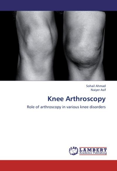 Knee Arthroscopy