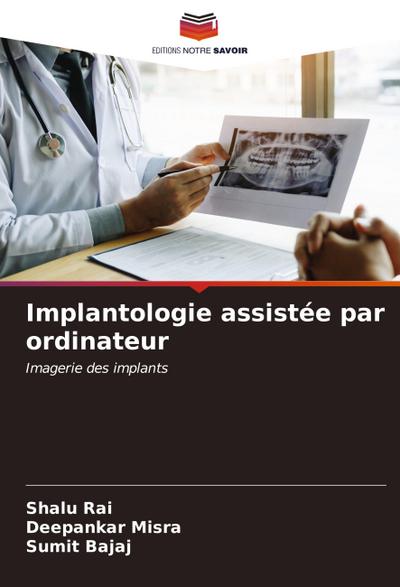 Implantologie assistée par ordinateur