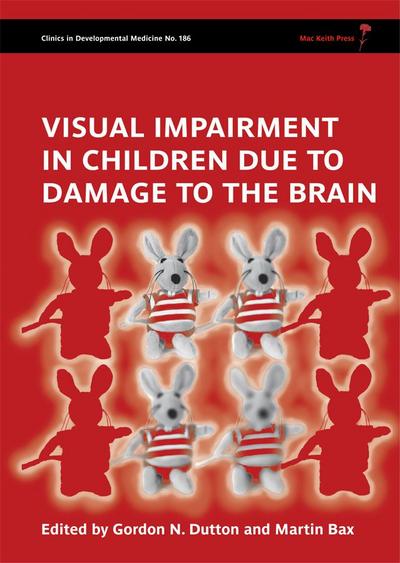 Visual Impairment in Children due to Damage to the Brain