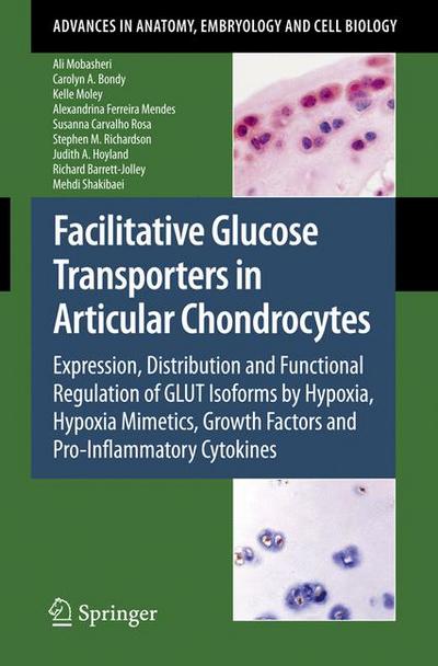 Facilitative Glucose Transporters in Articular Chondrocytes