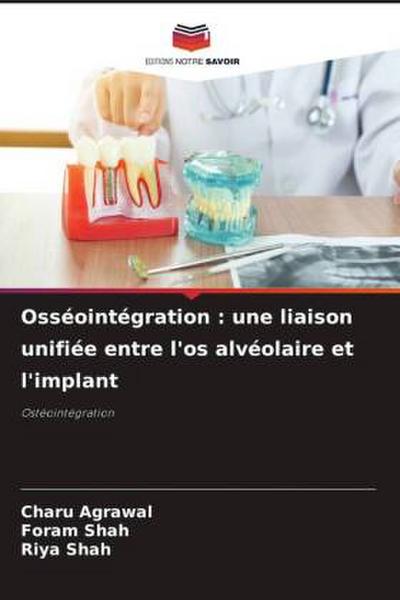 Osséointégration : une liaison unifiée entre l’os alvéolaire et l’implant