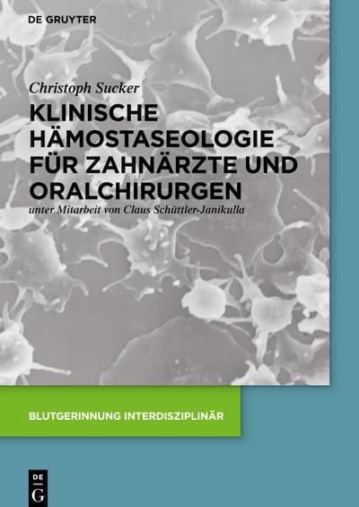 Klinische Hämostaseologie für Zahnärzte und Oralchirurgen