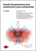 Aktuelle Therapieoptionen beim systemischen Lupus erythematodes