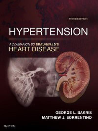Hypertension: A Companion to Braunwald’s Heart Disease E-Book