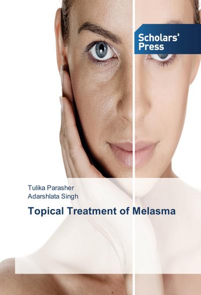 Topical Treatment of Melasma