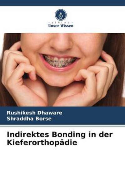 Indirektes Bonding in der Kieferorthopädie