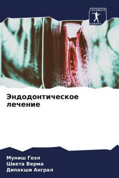 Jendodonticheskoe lechenie