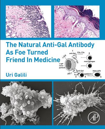 The Natural Anti-Gal Antibody as Foe Turned Friend in Medicine