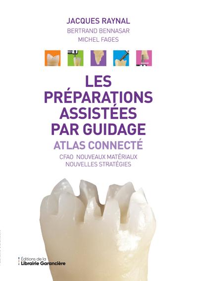 Les préparations assistées par guidage