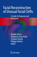 Facial Reconstruction of Unusual Facial Clefts