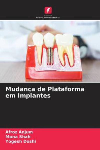 Mudança de Plataforma em Implantes
