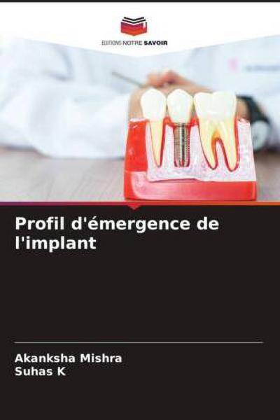 Profil d’émergence de l’implant