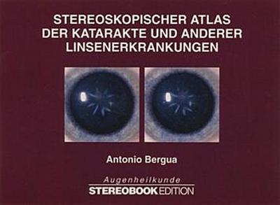Stereoskopischer Atlas der Katarakte und anderer Linsenerkrankungen, m. Stereobrille