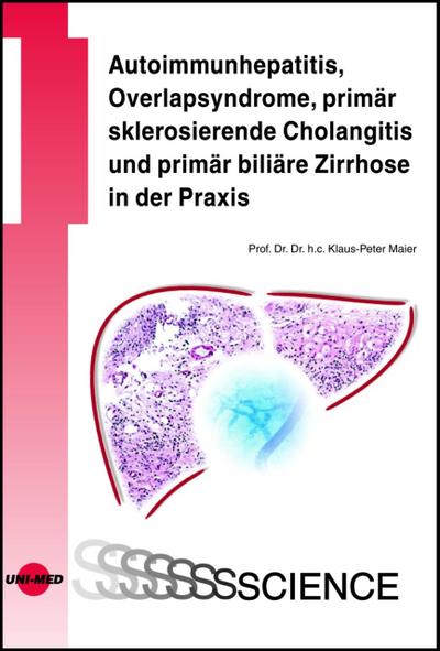 Autoimmunhepatitis, Overlapsyndrome, primär sklerosierende Cholangitis und primär biliäre Zirrhose in der Praxis