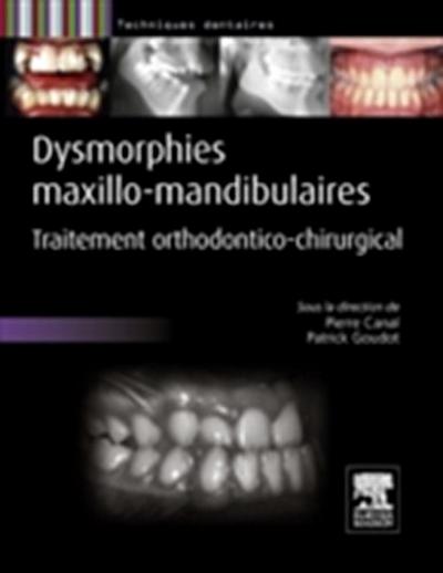 Dysmorphies maxillo-mandibulaires