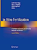 In Vitro Fertilization