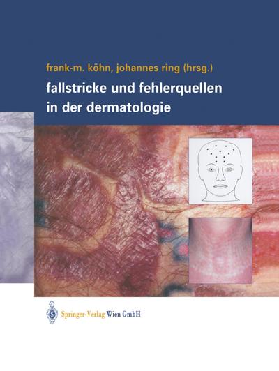 Fallstricke und Fehlerquellen in der Dermatologie