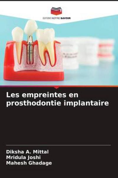 Les empreintes en prosthodontie implantaire