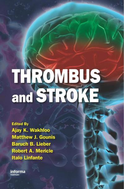 Thrombus and Stroke