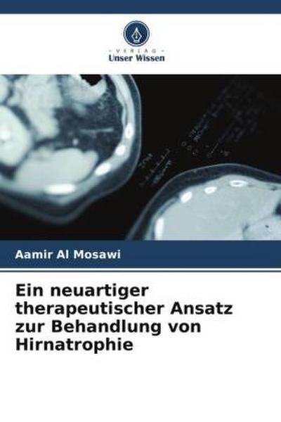 Ein neuartiger therapeutischer Ansatz zur Behandlung von Hirnatrophie