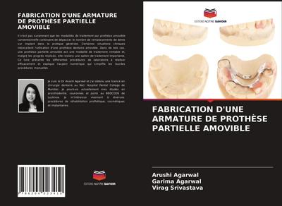 FABRICATION D’UNE ARMATURE DE PROTHÈSE PARTIELLE AMOVIBLE