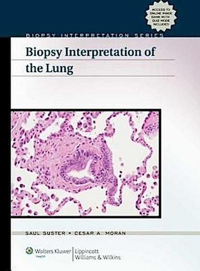 Suster, S: Biopsy Interpretation of the Lung