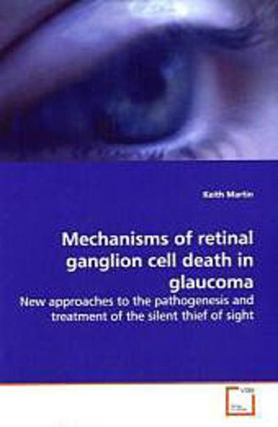 Mechanisms of retinal ganglion cell death in glaucoma