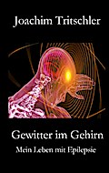 Gewitter im Gehirn
