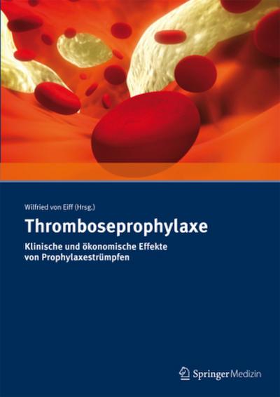 Thromboseprophylaxe
