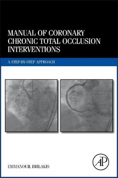 Manual of Coronary Chronic Total Occlusion Interventions
