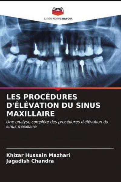 LES PROCÉDURES D’ÉLÉVATION DU SINUS MAXILLAIRE