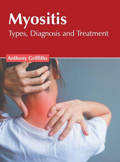 Myositis: Types, Diagnosis and Treatment