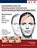 Illustrated Guide to Collagen Induction with Platelet-Rich Plasma (PRP)/Bildatlas Kollageninduktion mit Platelet Rich Plasma (PRP)