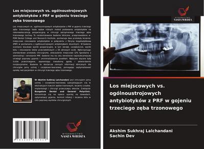 Los miejscowych vs. ogólnoustrojowych antybiotyków z PRF w gojeniu trzeciego z¿ba trzonowego